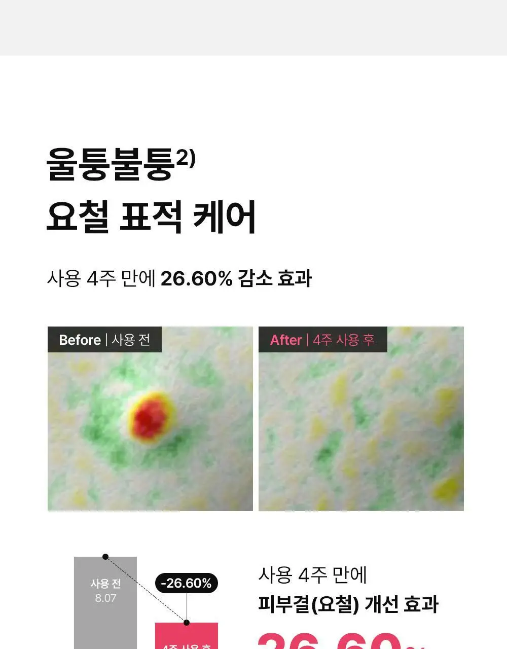 [트러블표적케어] 동아제약 아크네 프로 크림제 30ml 상세페이지 14
